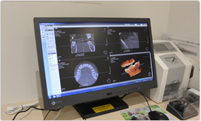 歯科用CT