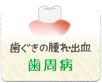 歯周病